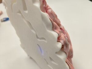 Silicone 1